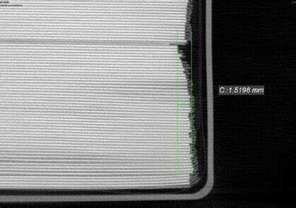 Disallineamento del pacchetto di elettrodi